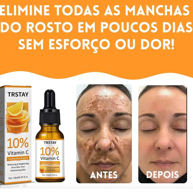 KIT Sérum Anti Manchas Vitamina C - Compre 1 leve 3  - Rumo ao milhão💸