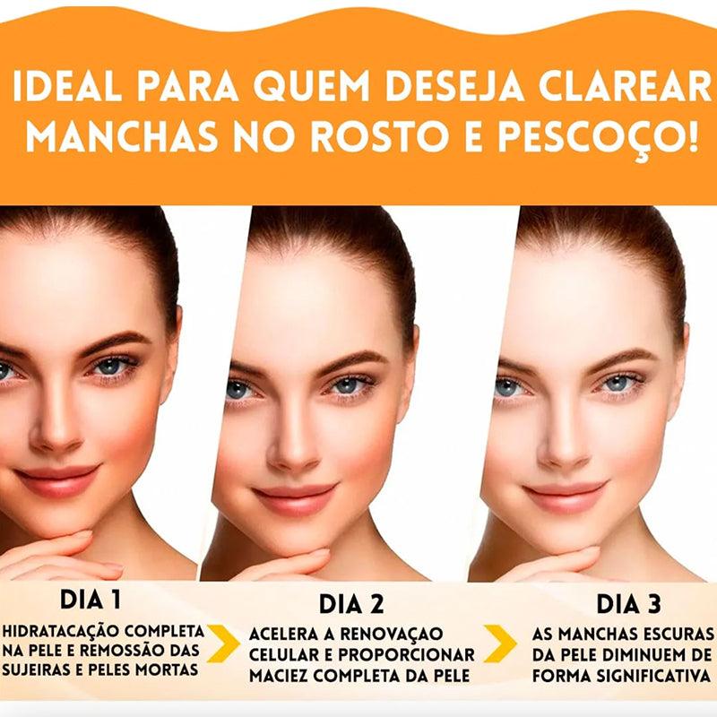 KIT Sérum Anti Manchas Vitamina C - Compre 1 leve 3  - Rumo ao milhão💸